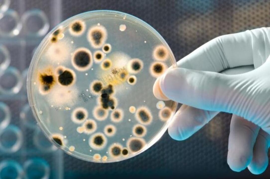 I batteri che causano la prostatite infettiva